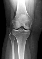 Zoom image: Radiological image