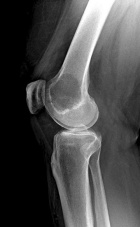 Zoom image: Radiological image