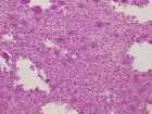 Zoom image: Cell stain