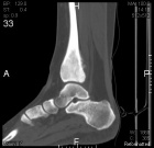 Zoom image: Radiological image