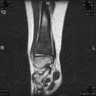 Zoom image: Radiological image