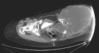 Zoom image: Radiological image