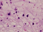 Zoom image: Cell stain
