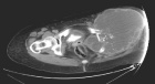 Zoom image: Radiological image
