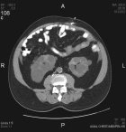 Zoom image: Radiological image