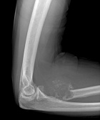 Zoom image: Radiological image