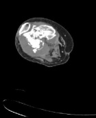 Zoom image: Radiological image