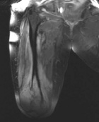Zoom image: Radiological image