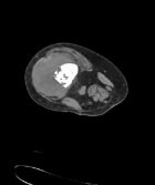 Zoom image: Radiological image