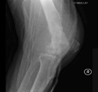 Zoom image: Radiological image