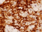 Zoom image: Cell stain