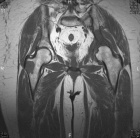 Zoom image: Radiological image