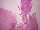 Zoom image: Cell stain