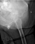 Zoom image: Radiological image