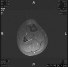 Zoom image: Radiological image