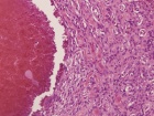 Zoom image: Cell stain
