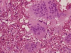 Zoom image: Cell stain
