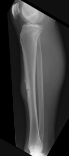 Zoom image: Radiological image