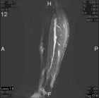 Zoom image: Radiological image