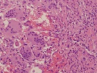 Zoom image: Cell stain