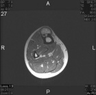 Zoom image: Radiological image
