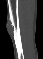 Zoom image: Radiological image