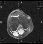 Zoom image: Radiological image