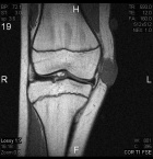 Zoom image: Radiological image