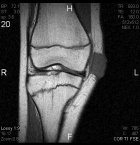 Zoom image: Radiological image