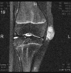 Zoom image: Radiological image