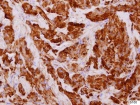 Zoom image: Cell stain