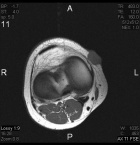 Zoom image: Radiological image