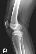 Zoom image: Radiological image