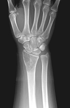 Zoom image: Radiological image