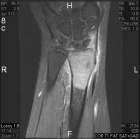 Zoom image: Radiological image