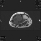 Zoom image: Radiological image
