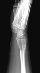 Zoom image: Radiological image