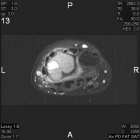 Zoom image: Radiological image