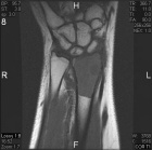 Zoom image: Radiological image