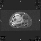 Zoom image: Radiological image