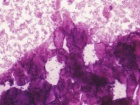 Zoom image: Cell stain