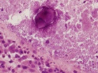Zoom image: Cell stain