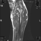 Zoom image: Radiological image