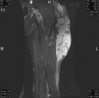Zoom image: Radiological image