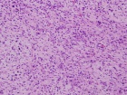 Zoom image: Cell stain
