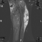 Zoom image: Radiological image