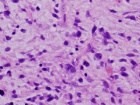 Zoom image: Cell stain
