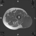 Zoom image: Radiological image