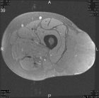 Zoom image: Radiological image