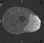 Zoom image: Radiological image